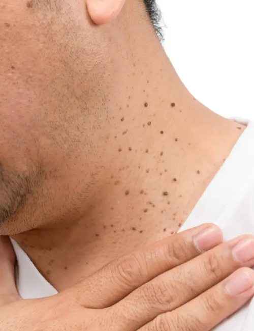 Private Dermatology Clinic in MK | Expert Dermatologists