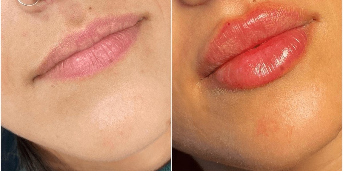Best Plastic Surgeons in Dubai for Skin Boost