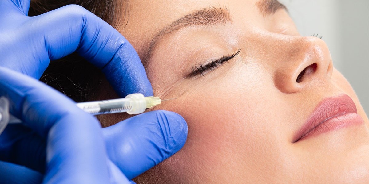 Botox in London: Understanding the Modern Aesthetic Treatment Journey