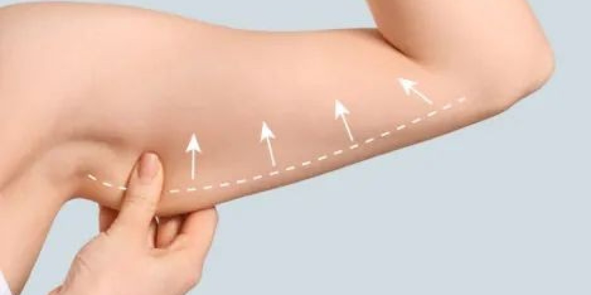 Arm Lift Surgery in Dubai: Advanced Arm Contouring