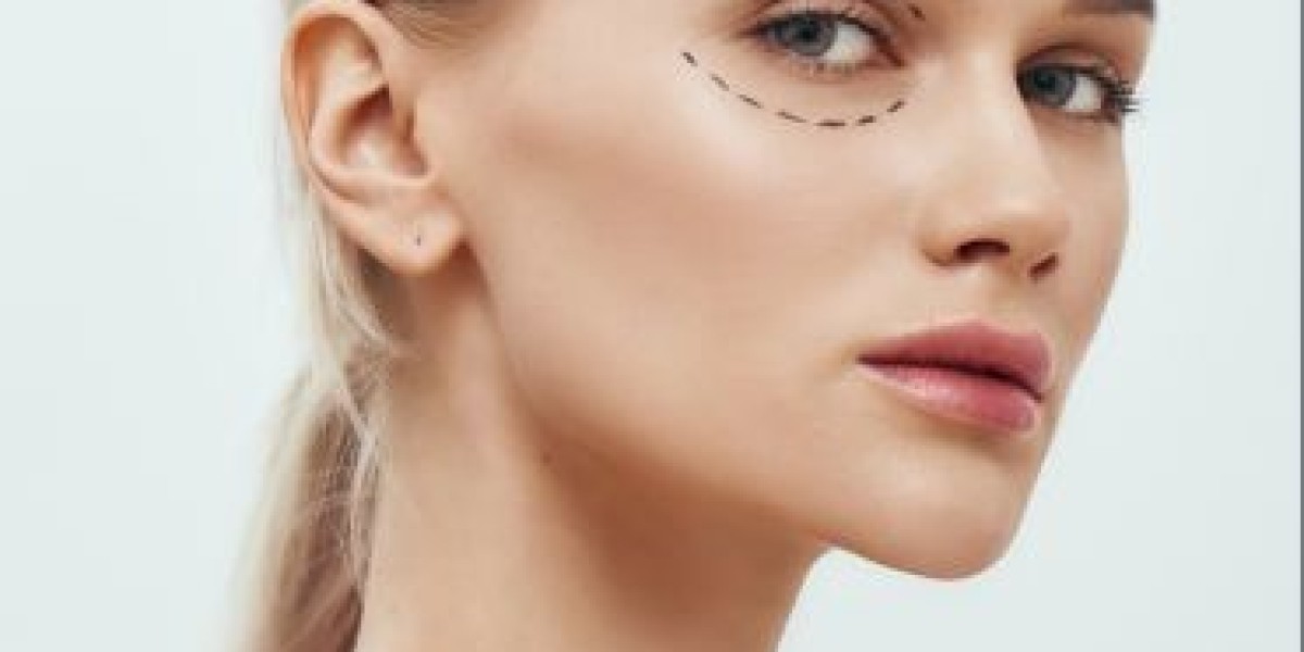 Blepharoplasty in Dubai: Reclaim Bright and Youthful Eyes