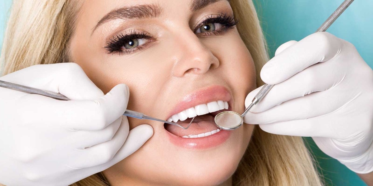 Veneers: How They Improve Your Smile