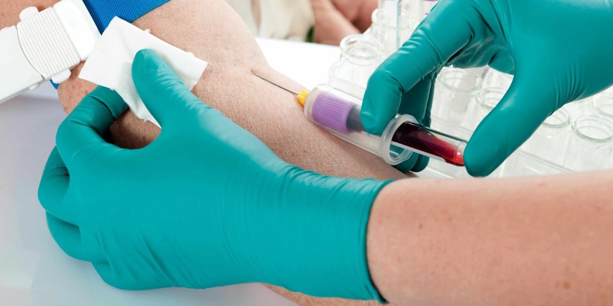 Blood Test Dubai for Accurate Health Monitoring