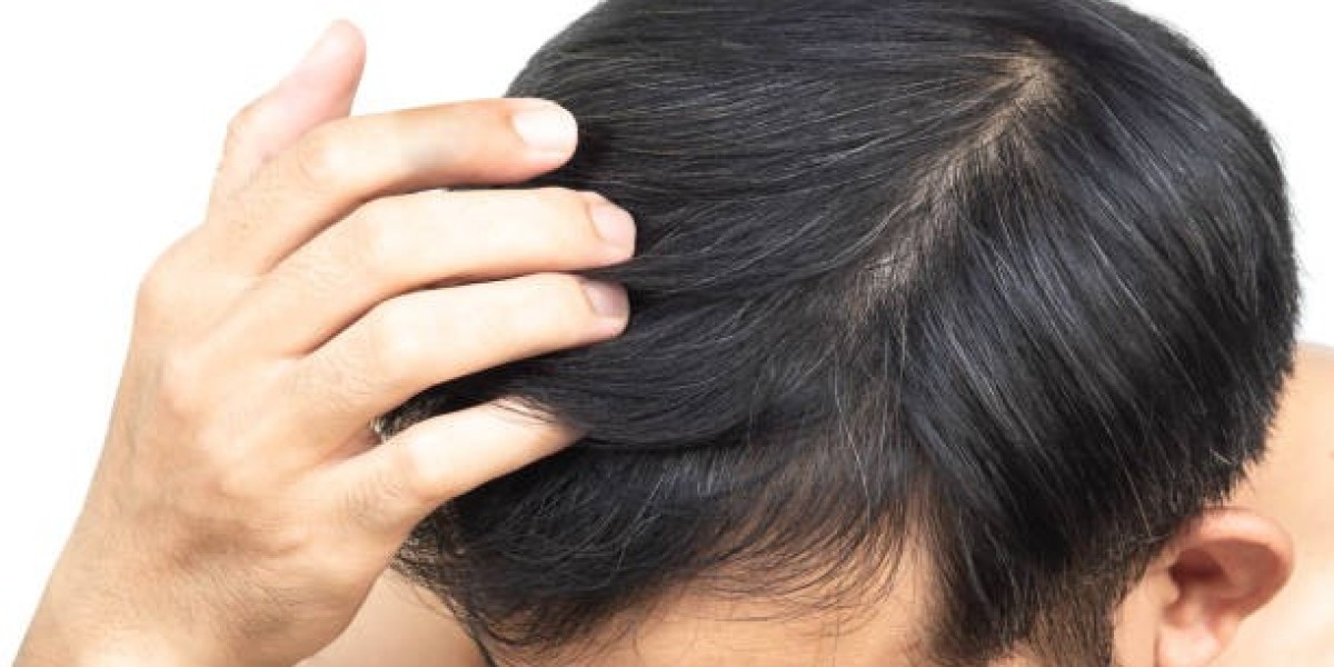 PRP Hair Treatment: Understanding Benefits, Process, and Recovery