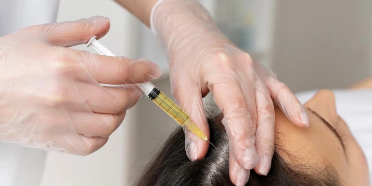 GFC Treatment vs PRP: Which Hair Loss Treatment Is Better?