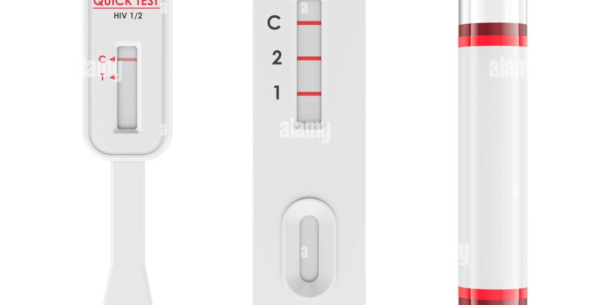 HIV Test in Dubai: Can HIV Be Detected Early?