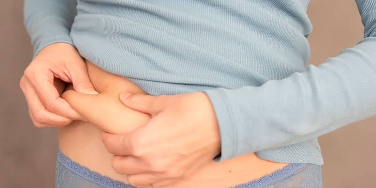 Why More Patients Trust Liposuction in Dubai for Fat Removal