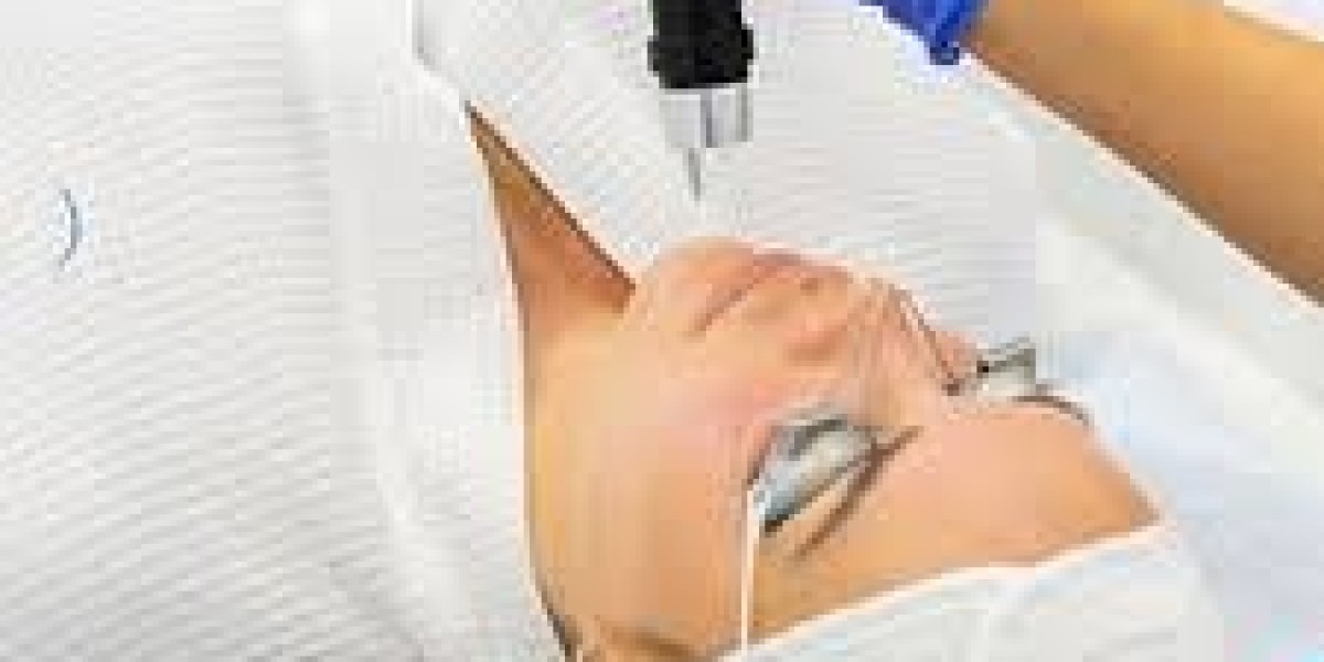 Pico Laser Treatment in Dubai | Advanced Skin Rejuvenation Solution
