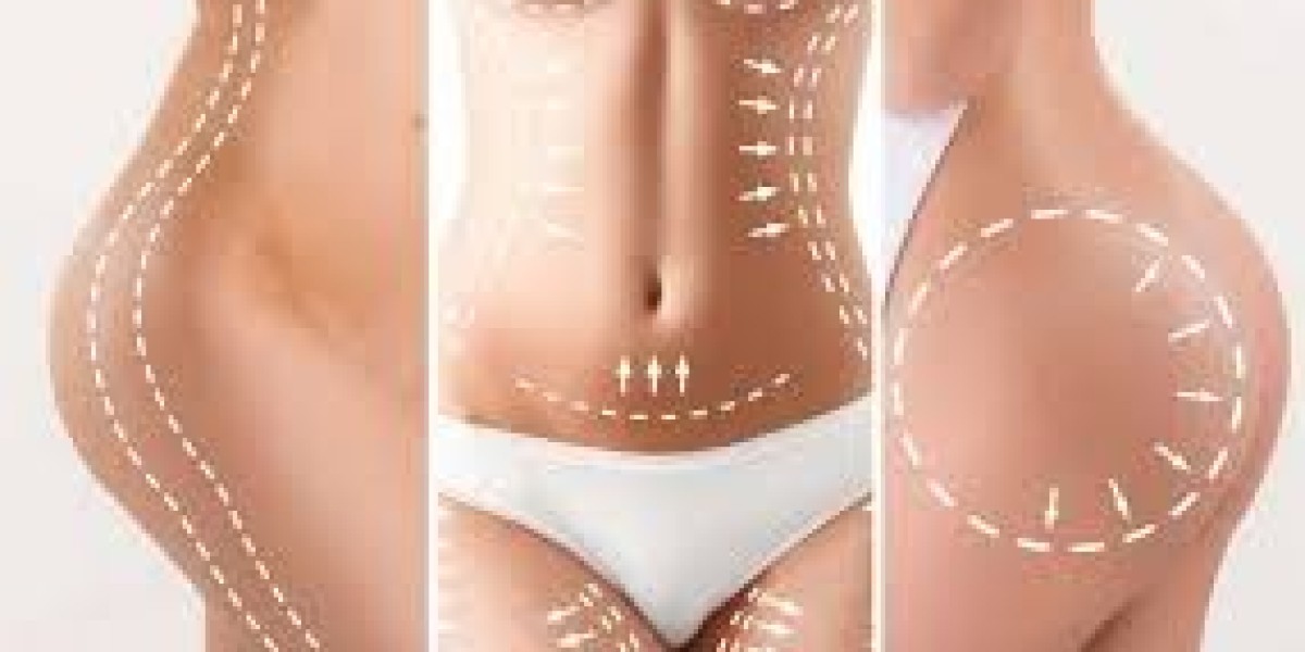 What Factors Determine Your Mommy Makeover Treatment Plan?
