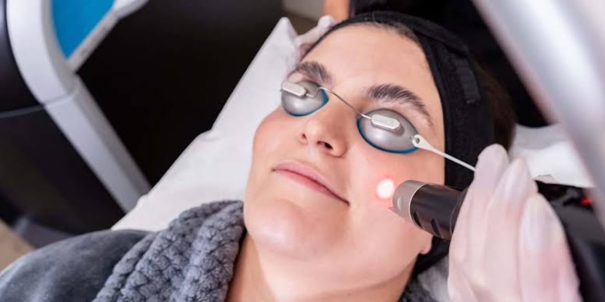 What makes Melasma Treatment popular?