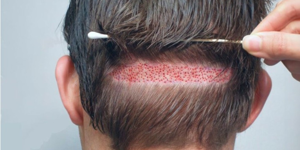 Top Reasons to Visit a Hair Specialist in Lahore