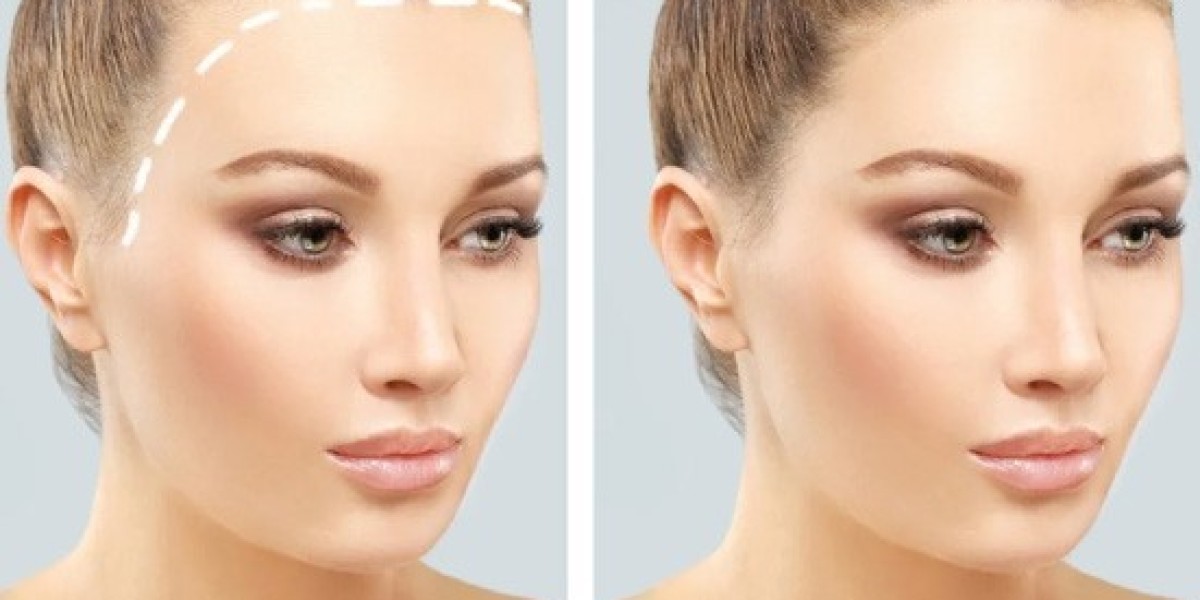 What Should You Look for When Choosing a Hair Transplant Clinic?