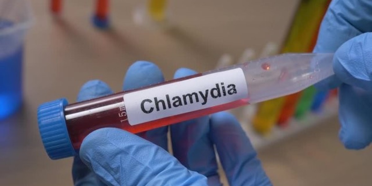 When Should You Repeat a Chlamydia Test?