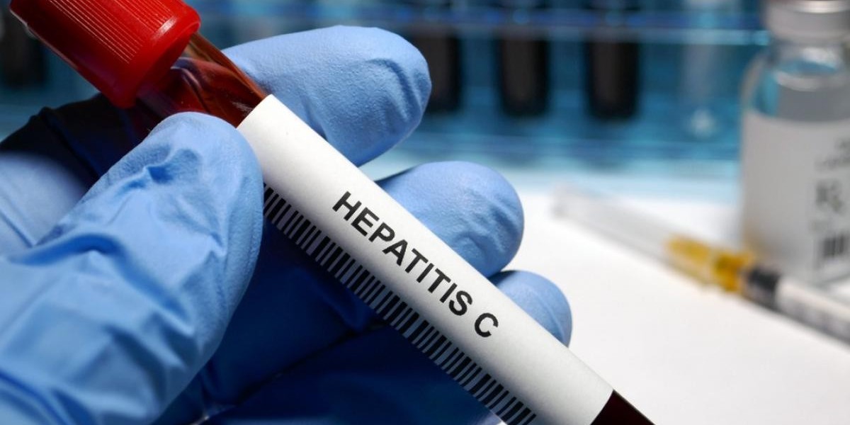 Hepatitis C Testing for Men and Women